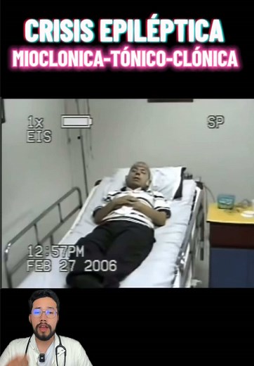 Crisis Epiléptica: MIOCLONICA y TÓNICO-CLONICA