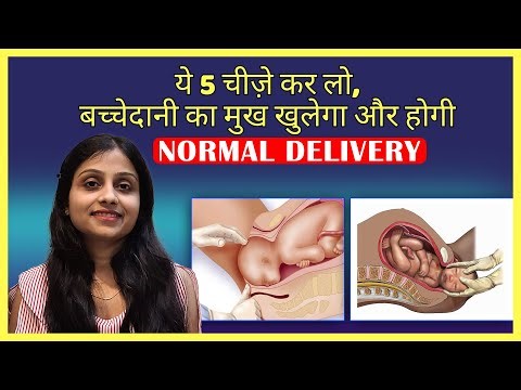 नॉर्मल डिलीवरी के लिए क्या करे ? BEST TIPS FOR NORMAL DELIVERY