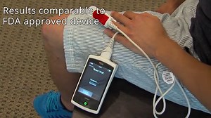 HemaApp screens for anemia, blood conditions without needle sticks