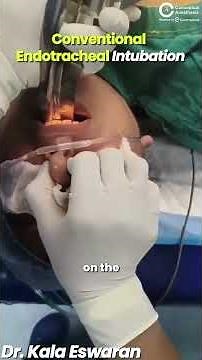 Master Conventional Endotracheal Intubation!