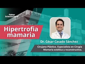 Hipertrofia mamaria o gigantomastia: qué es, cómo se diagnostica y cuál es su tratamiento.