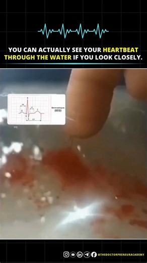 The Doctorpreneur Academy on Instagram: "This happens because arterial blood flow is pulsatile. Each heartbeat creates a pressure wave that pushes blood out in small rhythmic bursts ❤️‍🩹. When a finger cut hits a tiny artery and the hand is placed in water 💦, the blood spreads in visible pulses, creating a pattern that looks like a waveform 📈. It’s not an ECG just the heart’s mechanical rhythm showing through the blood flow. #medfacts #doctorcommunity #healthcareinfo #medreels #anatomybasics 