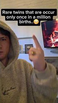 rare twins that are only occur once in a million births..😳