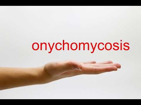 How to Pronounce onychomycosis - American English