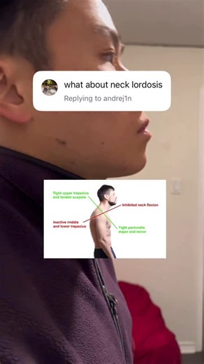 Nevin | Mobility & Strength Coach on Instagram: "Comment “lowback” to get a free guide to get you started on fixing your low back pain If we haven’t met hi my name is Nevin and I have helped hundreds of students from low back pain from sitting at office too much to Getting back into the gym and gaining strength. The system helps you 🤌🏻 solve your hip issues and not just stretching 🤌🏻create long lasting change to fix your low back 🤌🏻without chiro and endless massages If you’re ready to fix 