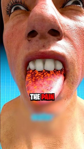 What To Do If You Burn Your Tongue? 😱