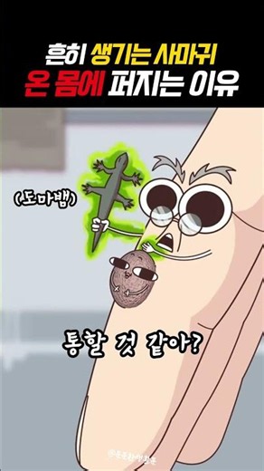 온 몸에 번지는 사마귀 냉동치료 가능할까? #건강정보 #사마귀