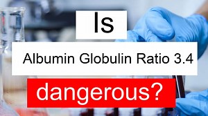 Is Albumin Globulin ratio 3.4 high, normal or dangerous? What does A/G ratio level 3.4 mean?