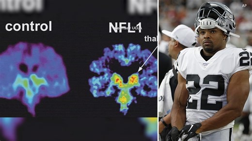 Brain of ex-NFL player Doug Martin reportedly to be tested for CTE following in-custody death