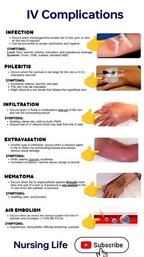 iv cannula complications | iv cannula #medical #ytshorts #viralshort