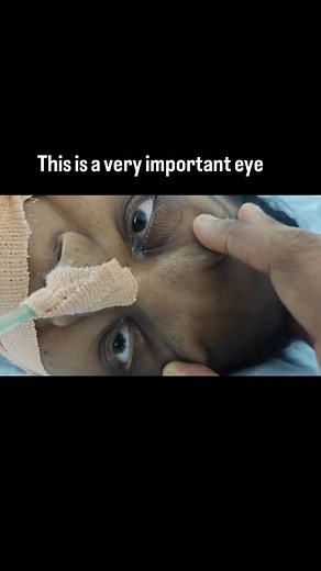 Dr M.Nirumal Khumar(Neuro nerd) on Instagram: "This is very useful icu eye finding which ll tell you why the pt is comatose. Due to cortical dysfunction or brainstem dysfunction (Roving eye movements, eye signs in coma) #Neurology#BrainHealth#NeuroScience#Neurologist#NeurologyAwareness#BrainScience#Neuro#Neurology#Neurologist#NeurologyAwareness#BrainScience#NeurologicalDisorders#NeurologyEducation#NeurologyUpdates#NeurologyLife#NeurologyClinic#NeurologyConference#NeurologyFacts#NeurologyCaseStud