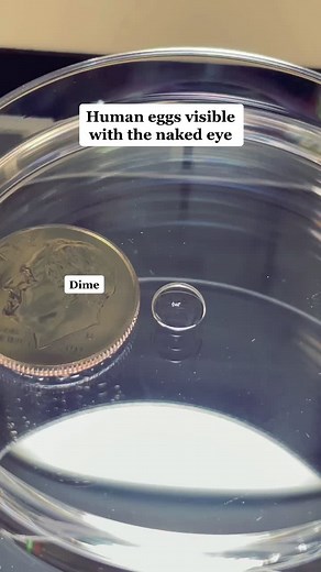 Can you see the one? 🤯 #ivf #science #sciencewithshaun