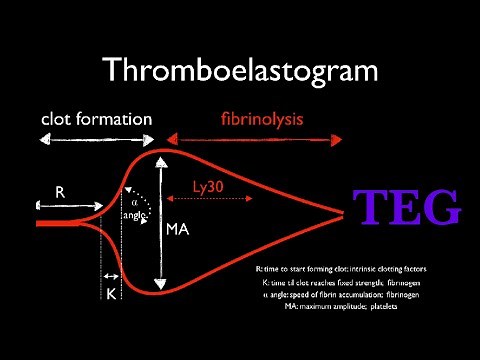 Thromboelastogram || TEG