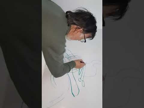 Explicación de Billroth I y Billroth II