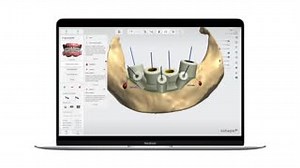 12 reactions | Are you working with advanced full arch cases in your practice? The newest version of 3Shape Implant Studio enables you to tackle this challenge using a bone-supported guide workflow while the hints and notifications system will help to guide you to ensure an optimal and predictable result! Learn more: https://www.3shape.com/en/software/implant-studio | 3Shape | Facebook