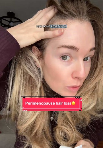 Perimenopause hair loss and hair thinning! Try pumpkin seed oil!😮@Micro Ingredients #tiktokshopcreatorpicks #momsoftiktok #hairthinning #femalehairloss #perimenopause