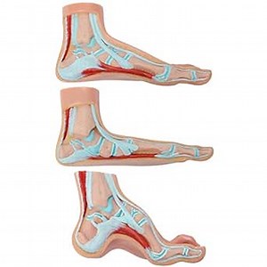 Axis Scientific Anatomy Model of Human Foot | Podiatry Model is a Set of 3 Human Feet | Foot Model Shows The Common Foot Conditions Flat Foot, Normal Foot and a High Arch