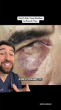 POV: You Want a Black Eye