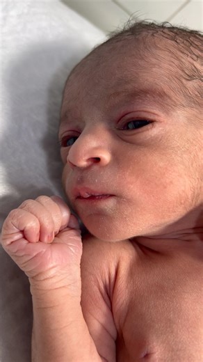 Cute Preterm Baby in NICU Relaxing After Warmth & Nursing Care 👶😴❤️ #PretermBaby #NICUBaby🤲🙏❤️