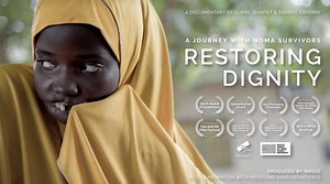 Noma documentary – Noma