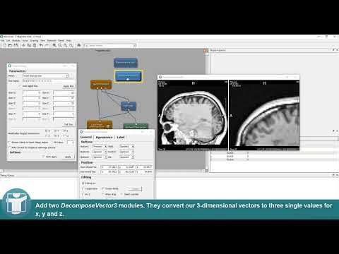MeVisLab Tutorials - Visualization - Creating a Magnifier