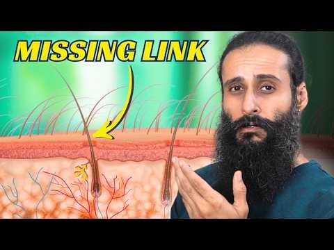 The Hidden Hormone Causing Hair Loss (Not DHT) | Bearded Chokra
