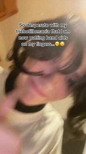 Understanding Trichotillomania and Coping Strategies