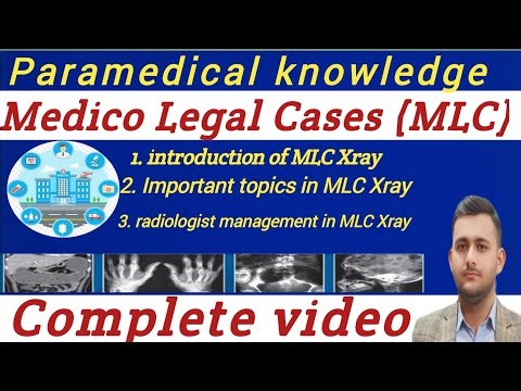 MLC X-ray (Medico Legal Cases) intro. and management in DRT=2 Complete Video💯#Accident #MLC #legal