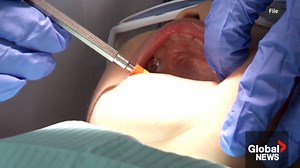 Some Maritimers smiling over new federal dental coverage, but gaps remain