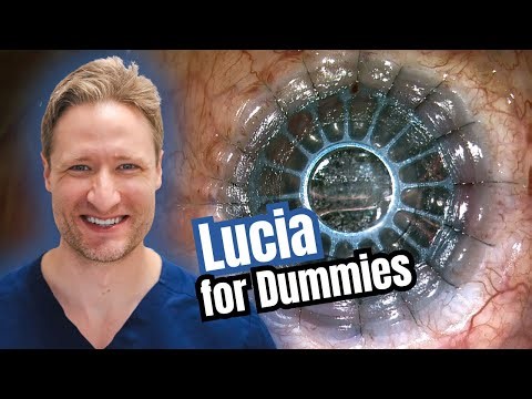 Assembling the “New” Lucia Boston Keratoprosthesis — A Simple How-To Guide