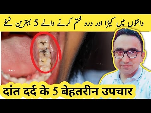 Top 5 Home Remedies For Tooth Cavity | Dental Carries