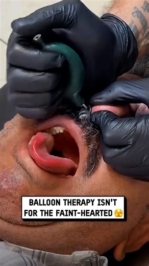 This technique is designed to completely clear sinuses 🎈😲 #satisfying #therapy #balloons | UNILAD