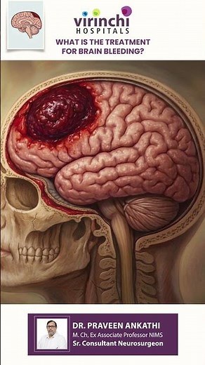 What is the Treatment for Brain Bleeding? | Expert Advice from Dr. Praveen Ankathi | #neurosurgeon