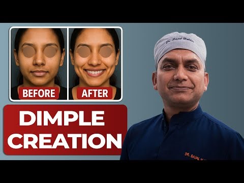 Dimple Creation Surgery or Dimpleplasty #plasticsurgery #beautifulfaces #cosmeticsurgery