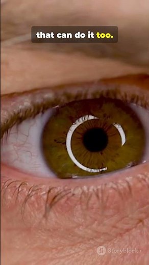 Why Your Eye Won’t Stop Twitching (Fix This)