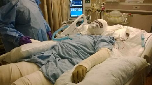 Woman's skin 'melts off' after medication error