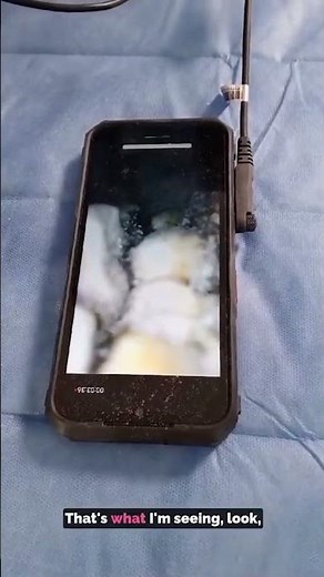 Scientists studying 'alien mummies' from Peru make startling find while probing their mouths