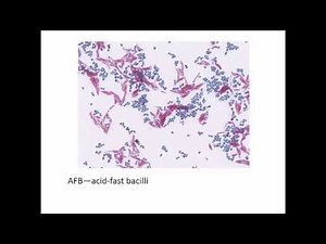Microscopy, Staining and Culturing Techniques Part 2