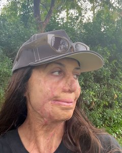 4.4K views · 302 reactions | Turia Pitt on Reels | Facebook