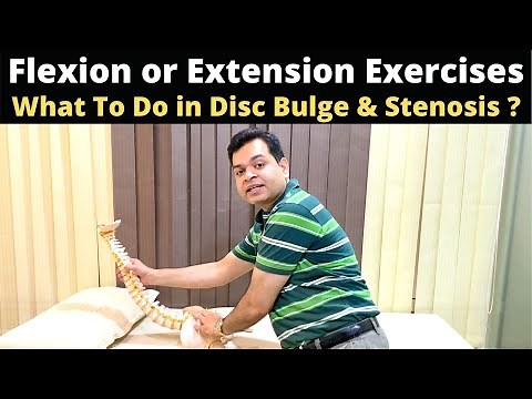 When To Do Flexion or Extension Exercises for low back pain, lumbar canal Stenosis Exercises