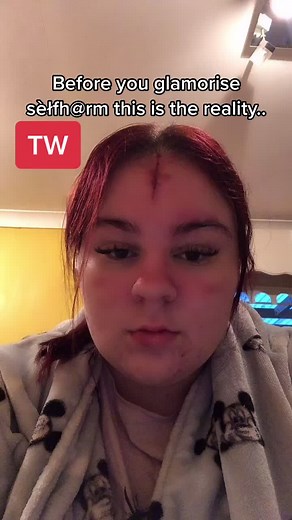 TW⚠️ got this from @mayalilyxox all this was in the past but I’m still not doing well #mentalhealthawareness #mentalhealthmatters