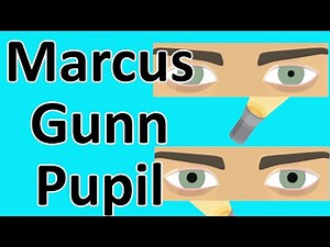 Marcus Gunn Pupil