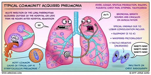 Learn typical community acquired pneumonia with a Medcomic