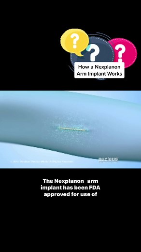 Nexplanon Arm Implant #birthcontrol #nexplanon #armimplant #birthcontrolcheck #larc #fyp #explorepage