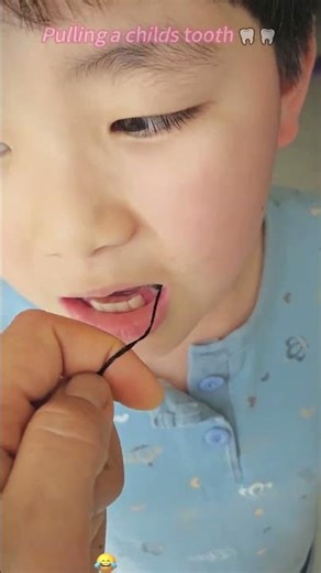 Pulling a child's tooth? 🦷 That's crazy! 😂#funny#fyp#prank#scary#foryou