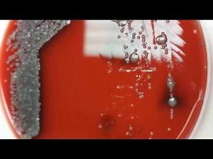 Moraxella hockey puck sign