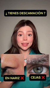¿TIENES DESCAMACIÓN Y ROJEZ ñEN NARIZ Y CEJAS ? ESTO ES DERMATITIS SEBORREICA #dermatitis #dermatitisseborreica #cuidadodelapiel #skincare #pielsana | Marta Diez
