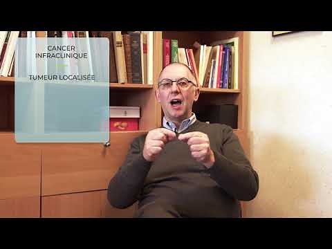 Quels sont les différents stades du cancer de la prostate ?