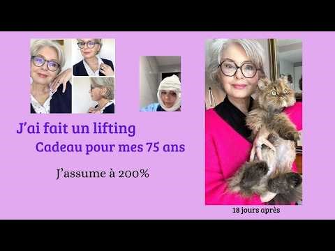 I treated myself to a facelift for my 75th birthday