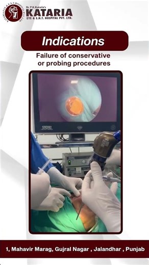 👁️ Endoscopic DCR ProcedureA modern, minimally invasive solution for blocked tear ducts